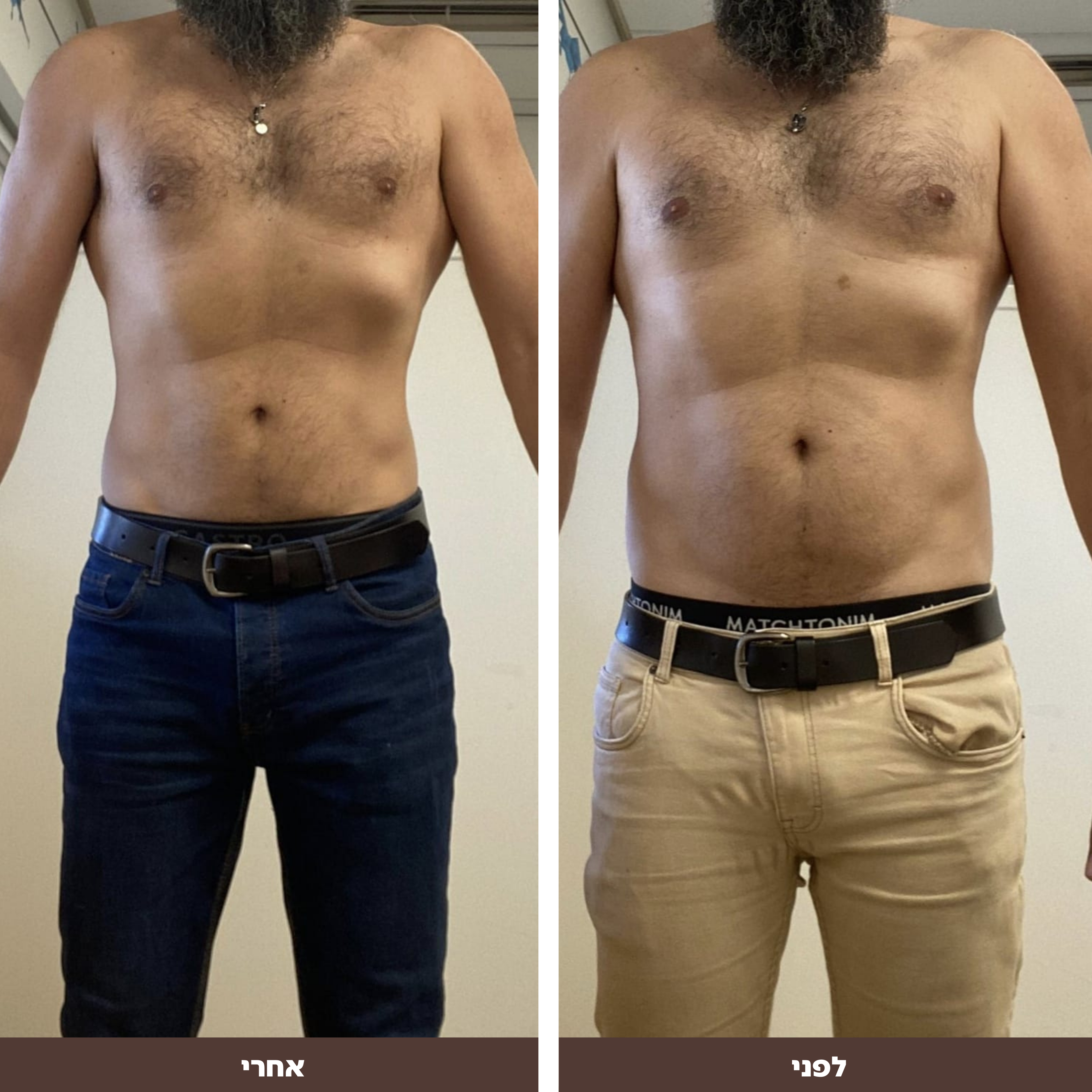 שי לפני אחרי